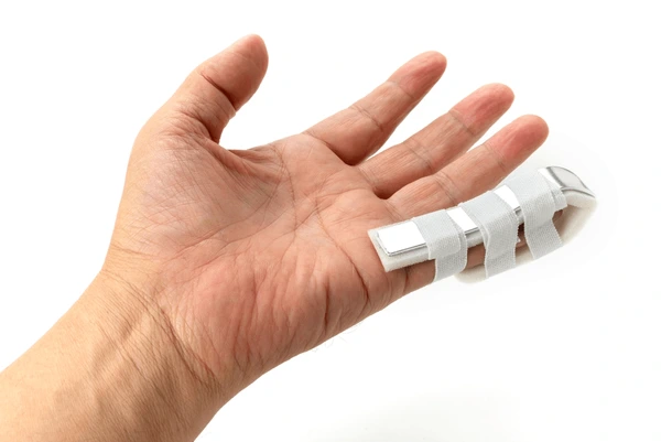 broken pinky finger orthopedic cast 600nw 2368706727